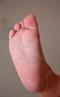 Printable skin and bone, the next medical advance?