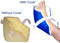 Convoluted Foam Heel & Elbow Pads
