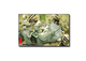 Medical: Patient Care and Surgical Devices